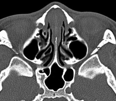 Fig 1.
