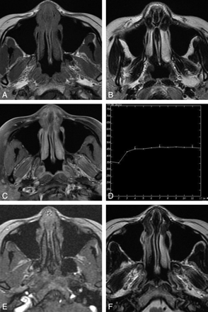 Fig 3.