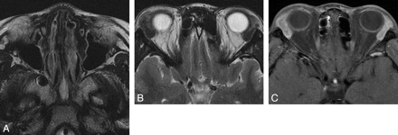 Fig 4.