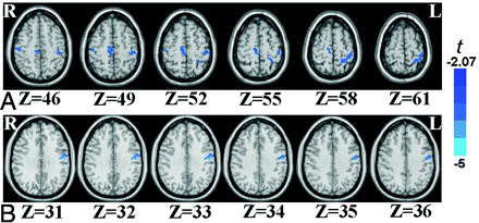 Fig 3.