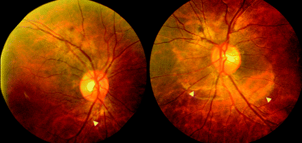 Fig 1.