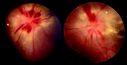 Fig 3.