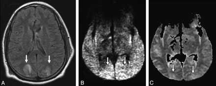 Fig 4.