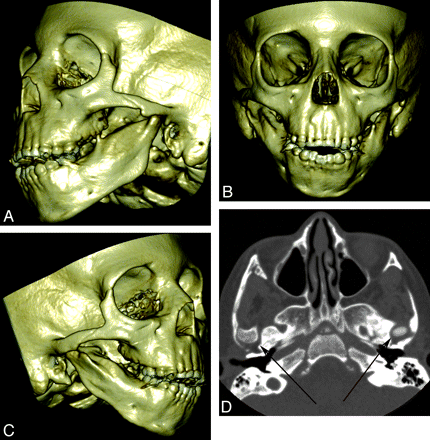 Fig 2.