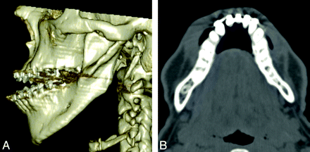 Fig 3.