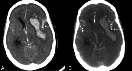 Fig 3.