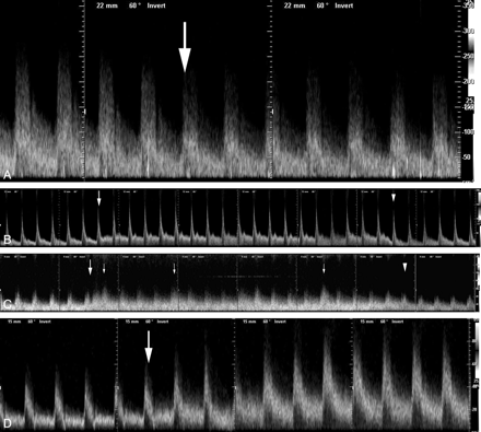Fig 1.