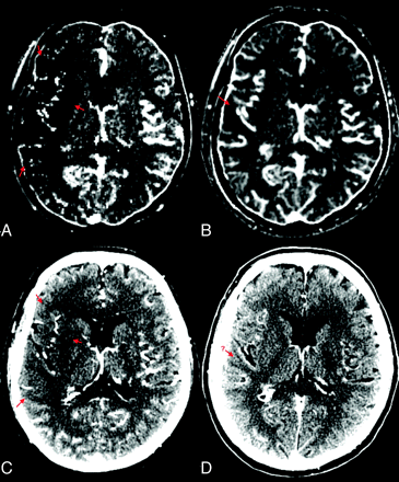 Fig 4.