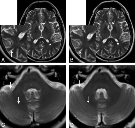 Fig 2.