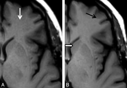 Fig 3.