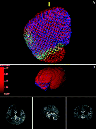 Fig 3.