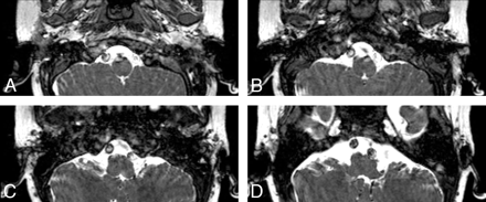 Fig 1.