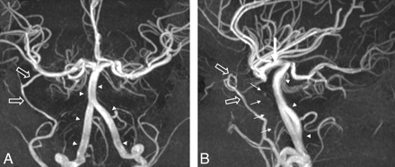 Fig 2.