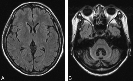 Fig 1.