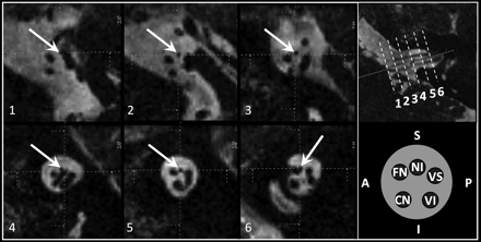 Fig 2.