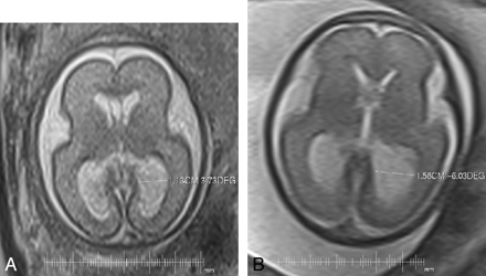 Fig 1.