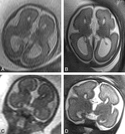 Fig 3.