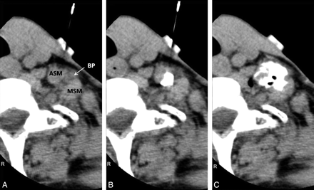 Fig 4.