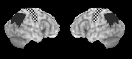 Fig 1.