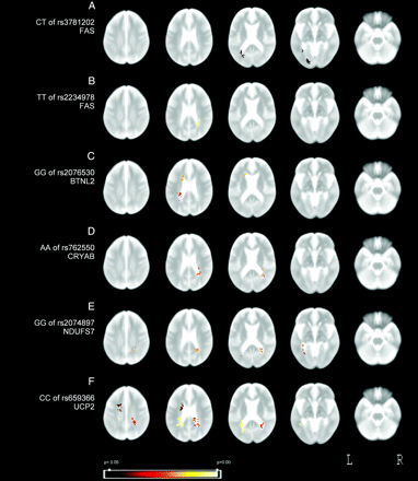 Fig 3.