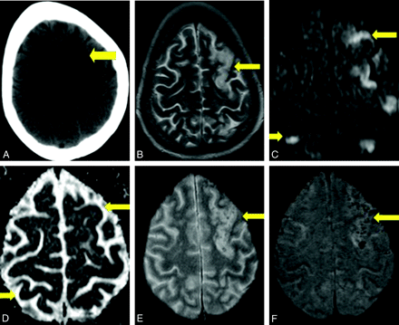 Fig 1.