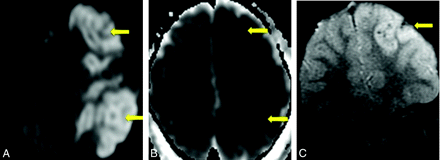 Fig 2.