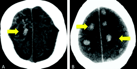 Fig 3.