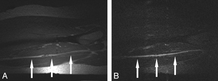 Fig 2.