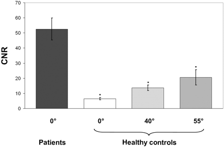 Fig 4.