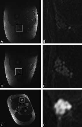 Fig 5.