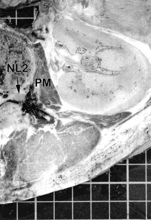 Fig 8.