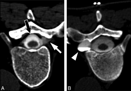 Fig 5.