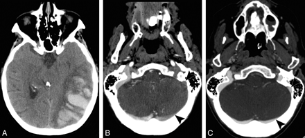 Fig 2.