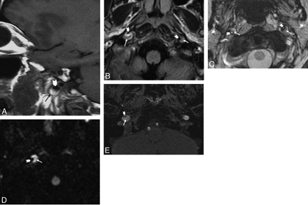 Fig 2.