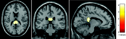 Fig 2.