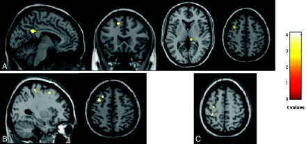 Fig 3.