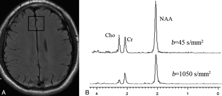 Fig 1.