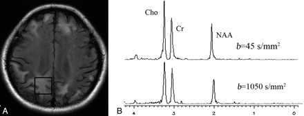 Fig 3.