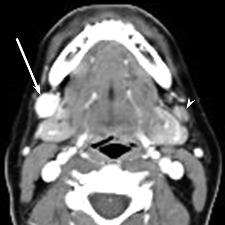 Fig 1.