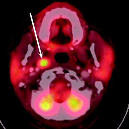 Fig 2.