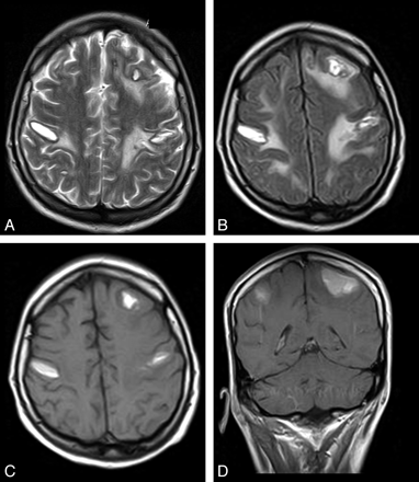Fig 1.