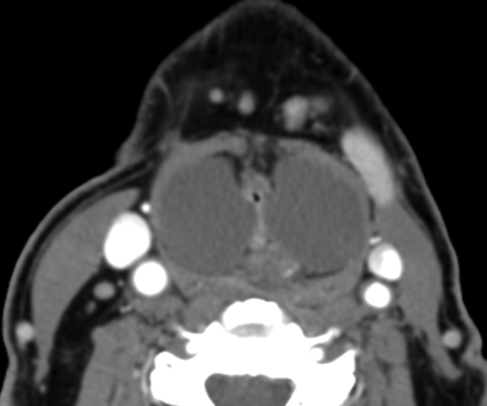 Fig 1.