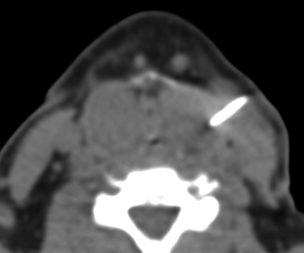 Fig 2.
