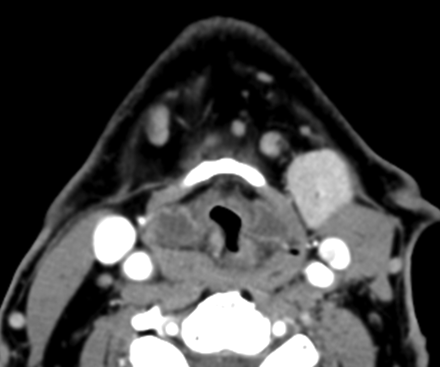 Fig 3.