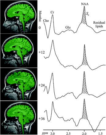 Fig 1.