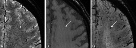 Fig 3.