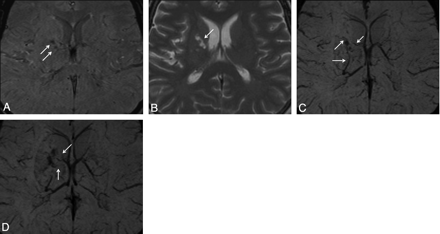 Fig 2.