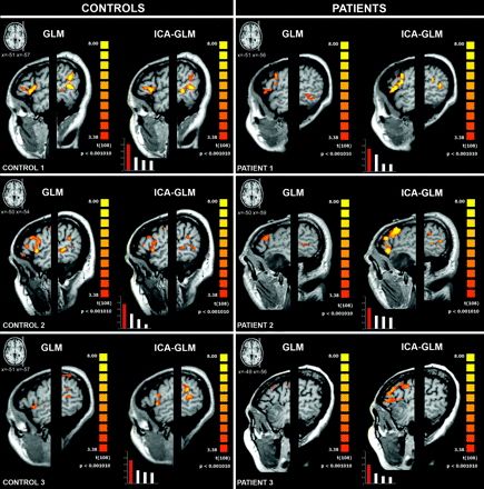 Fig 3.