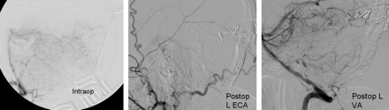 Fig 2.