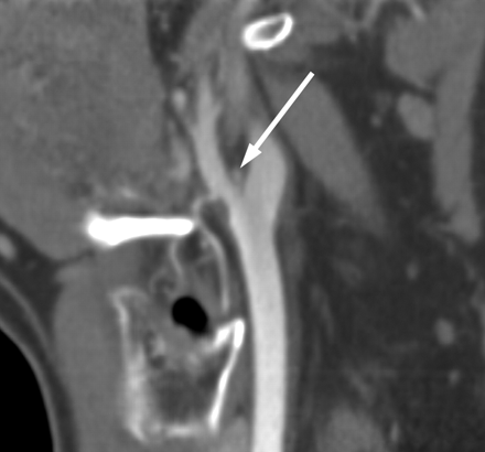 Fig 2.